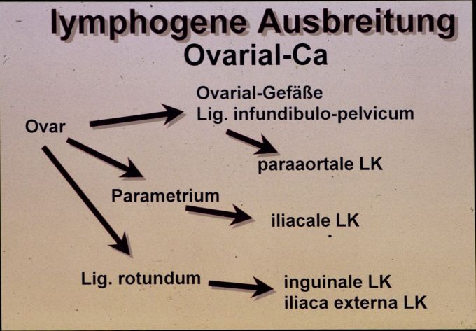 lymphogene Ausbreitung