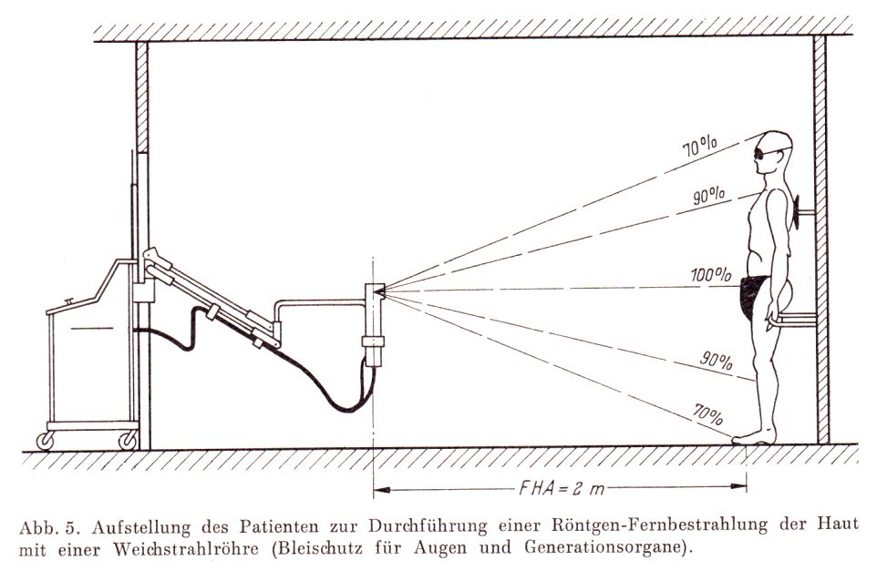 Ganzkörper-Weichstrahl-Behandlung