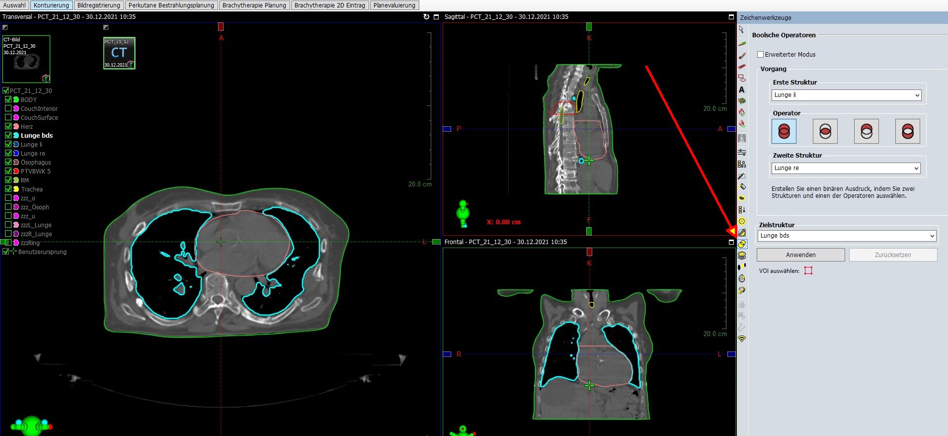 Boolsche Operationen